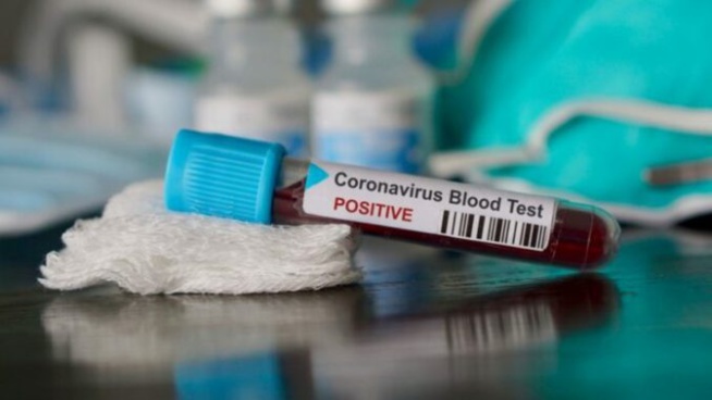 Test coronavirus : Le Senegal bat le record de rapidité Test coronavirus : Le Senegal bat le record de rapidité