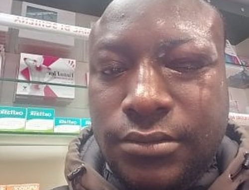 Italie : Le Sénégalais déjoue un cambriolage, perd un oeil et gagne des félicitations Italie : Le Sénégalais déjoue un cambriolage, perd un oeil et gagne des félicitations