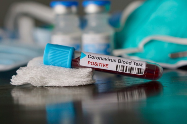 Coronavirus : La région de Louga enregistre son premier cas