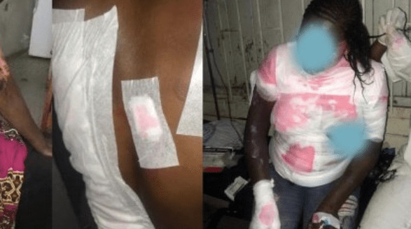 Gueule-Tapée: Ndèye Maty Fall explique pourquoi elle a ébouillanté ses trois belles-filles Gueule-Tapée: Ndèye Maty Fall explique pourquoi elle a ébouillanté ses trois belles-filles