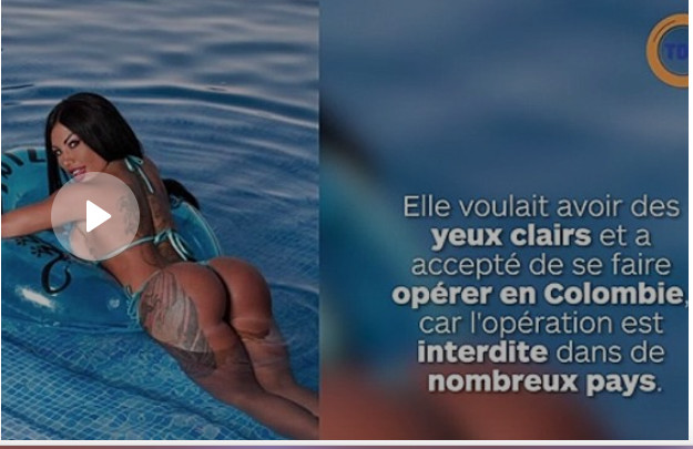 Elle a voulu faire changer la couleur de ses yeux, aujourd’hui elle est presque aveugle !