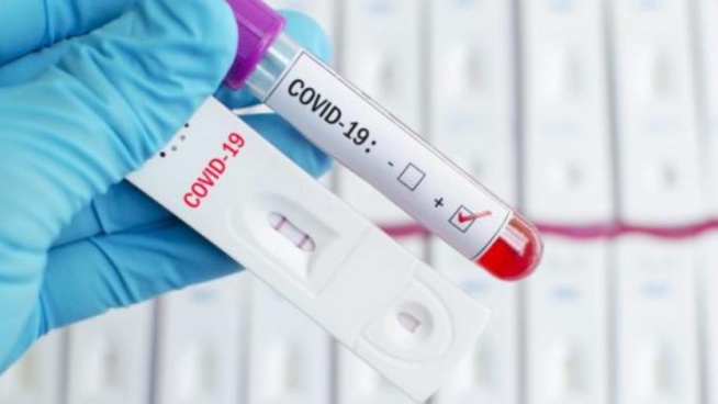 Covid-19 à Tamba : Cette découverte importante sur les 3 cas communautaires de ce lundi Covid-19 à Tamba : Cette découverte importante sur les 3 cas communautaires de ce lundi