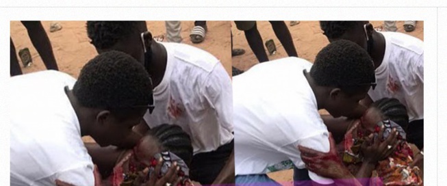 Cap Skirring: annoncé mort, Des nouvelles de la dame qui a été grièvement touchées à l’œil Cap Skirring: annoncé mort, Des nouvelles de la dame qui a été grièvement touchées à l’œil