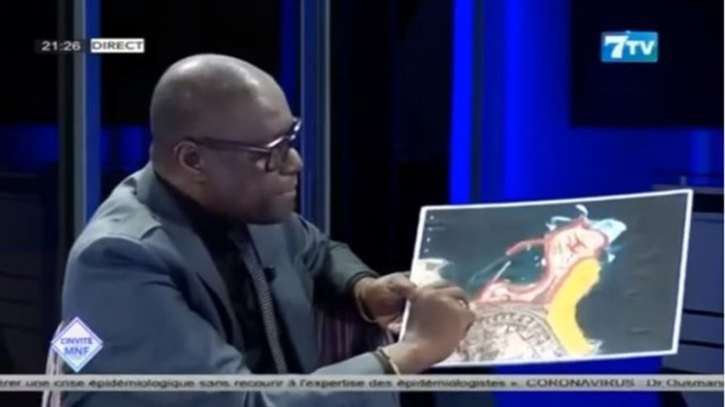 Grosses révélations de Atepa: « Barth a raison sur le terrain attribué à Djibril Diallo.. »
