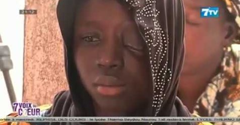 La douloureuse histoire d’une jeune fille qui a perdu un œil La douloureuse histoire d’une jeune fille qui a perdu un œil