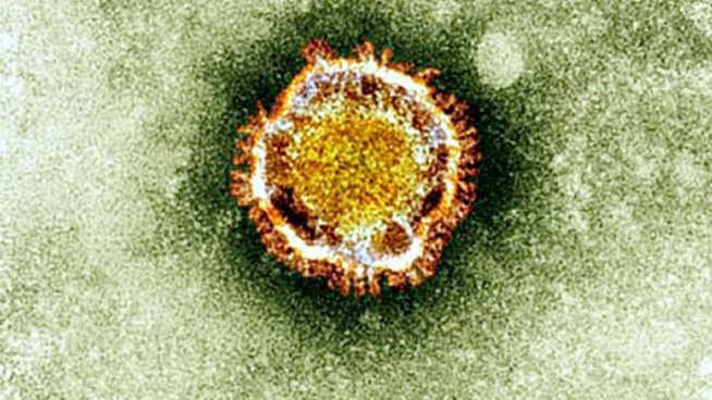 Coronavirus: 225 employés d'un abattoir en quarantaine en Belgique