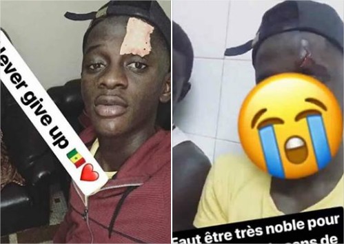 Jaaw Ketchup revient sur son agression et confie « Abba dou nitou dara…