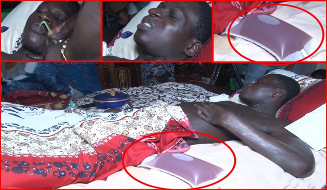 Paralysé suite à un @cc!d€nt en mission au Mali cheikh Ndiaye demande de l’aide et dément la DIRPA