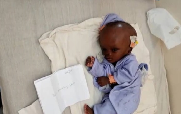 Appel à la solidarité : leur bébé souffrant d’hydrocéphalie dans l'attente d'une opération, une famille sollicite un soutien d’urgence