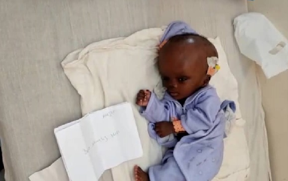 Appel à la solidarité : leur bébé souffrant d’hydrocéphalie dans l'attente d'une opération, une famille sollicite un soutien d’urgence Appel à la solidarité : leur bébé souffrant d’hydrocéphalie dans l'attente d'une opération, une famille sollicite un soutien d’urgence