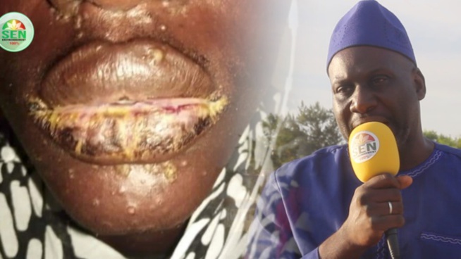 Ibrahima Kane, Dg Global Environnement: “ceci n’est pas nouveau en Afrique, c’est du poison versé…” Ibrahima Kane, Dg Global Environnement: “ceci n’est pas nouveau en Afrique, c’est du poison versé…”