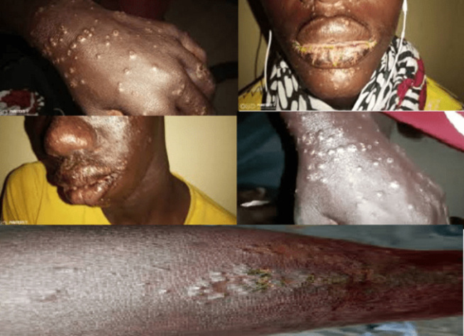 Apparition d’une maladie mystérieuse : Ce que disent les résultats de l’analyse de l’eau de mer de la brigade environnementale Apparition d’une maladie mystérieuse : Ce que disent les résultats de l’analyse de l’eau de mer de la brigade environnementale