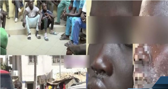 Maladie mystérieuse: Abdou Karim Sall soupçonne qu'elle soit d’origine algale Maladie mystérieuse: Abdou Karim Sall soupçonne qu'elle soit d’origine algale