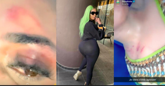 Ch0c : La jet setteuse Doro Binta sauvagement agressée à Dakar… âmes sensibles s’abstenir ! Li niaw na Ch0c : La jet setteuse Doro Binta sauvagement agressée à Dakar… âmes sensibles s’abstenir ! Li niaw na