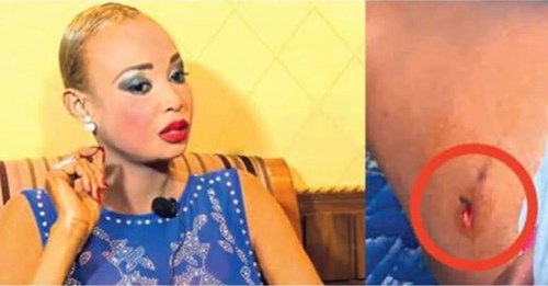 Abidjan: Tout savoir sur l’agression de Fabienne Feliho par un garde du corps de Macky Sall Abidjan: Tout savoir sur l’agression de Fabienne Feliho par un garde du corps de Macky Sall