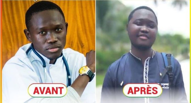 Médecin malade : Voici l’incroyable contribution du PASTEF Médecin malade : Voici l’incroyable contribution du PASTEF