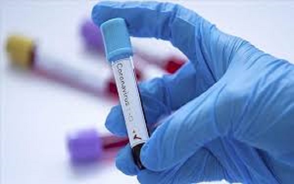 Situation de la COVID-19 au Sénégal: 186 nouvelles contaminations, dont 113 cas communautaires, 5 décès enregistrés Situation de la COVID-19 au Sénégal: 186 nouvelles contaminations, dont 113 cas communautaires, 5 décès enregistrés