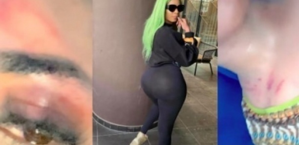 Grosse bagarre entre la Jetsetteuse Dora Binta et son petit ami