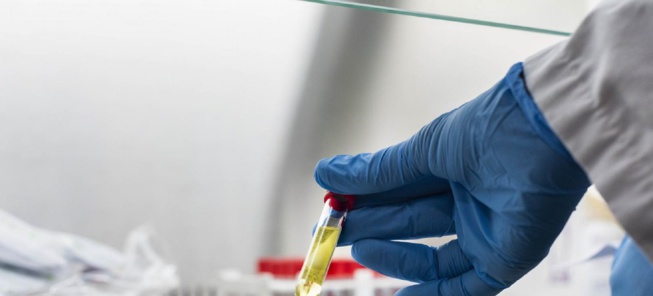 Covid-19: Le prix des tests rapides divisé par deux pour les pays en développement