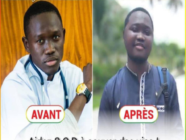 L'étudiant SOD évacué à Bordeaux, plus de 272 millions F Cfa mobilisés L'étudiant SOD évacué à Bordeaux, plus de 272 millions F Cfa mobilisés