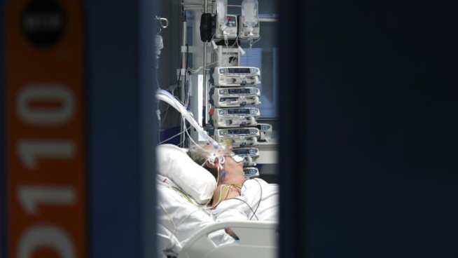 Covid-19: la mortalité en réanimation a chuté dans le monde mais ce progrès pourrait stagner Covid-19: la mortalité en réanimation a chuté dans le monde mais ce progrès pourrait stagner