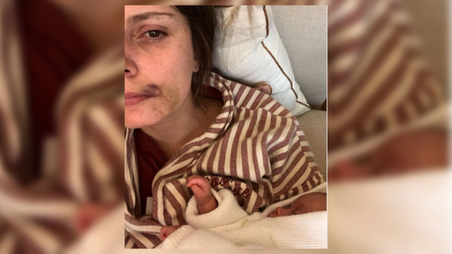 Une mère agressée dans son immeuble avec son nourrisson, Schiappa et Darmanin réagissent Une mère agressée dans son immeuble avec son nourrisson, Schiappa et Darmanin réagissent