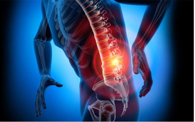 Zoom sur cette maladie à l'origine des déboires de Sonko Zoom sur cette maladie à l'origine des déboires de Sonko