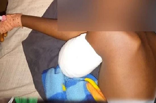 Manifestations de soutien à Ousmane Sonko : l’élève amputé du bras est sorti de l’hôpital Manifestations de soutien à Ousmane Sonko : l’élève amputé du bras est sorti de l’hôpital