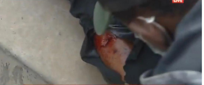 Audition de Sonko: un cadreur de Ouest Tv blessé par balle Audition de Sonko: un cadreur de Ouest Tv blessé par balle