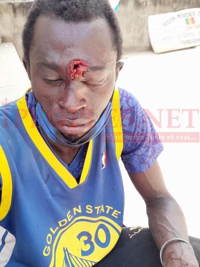 Contre l’arrestation de Ousmane Sonko: Un mort et deux blessés graves à Bignona