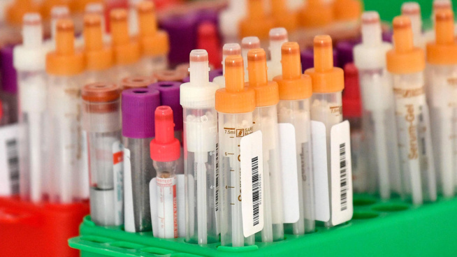 L'Agence européenne des médicaments publie des recommandations sur le traitement du Covid-19 L'Agence européenne des médicaments publie des recommandations sur le traitement du Covid-19