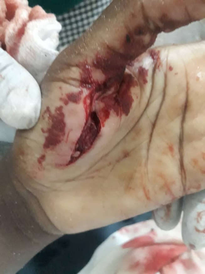 Tentative de viol sur une sage-femme: L'auteur arrêté (image choquante, âmes sensibles s'abstenir) Tentative de viol sur une sage-femme: L'auteur arrêté (image choquante, âmes sensibles s'abstenir)