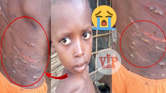 Alerte à Sidy Gassama, Oustaz Matar Sarr, ONG Jamra,vidéo ch0quante sur ce petit talibé malmené par son marabout à Missira.