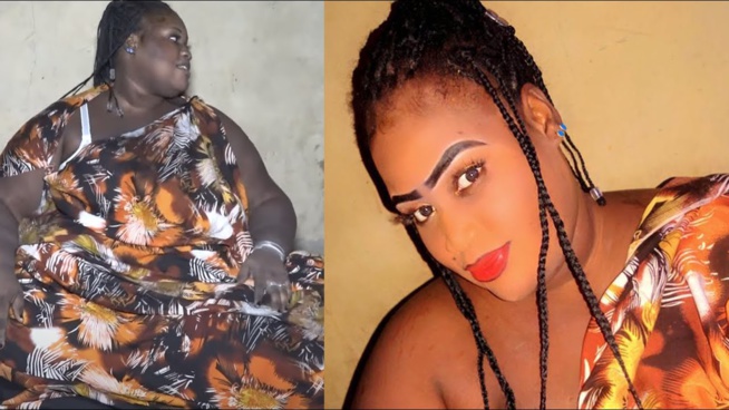 Affaire Fambaye : Macky Sall entre en jeu et prend en charge les frais d'opération à l'étranger Affaire Fambaye : Macky Sall entre en jeu et prend en charge les frais d'opération à l'étranger