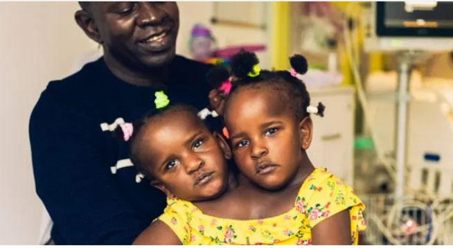 Les siamoises Sénégalaises Ndèye et Marème marchent pour la première fois Les siamoises Sénégalaises Ndèye et Marème marchent pour la première fois