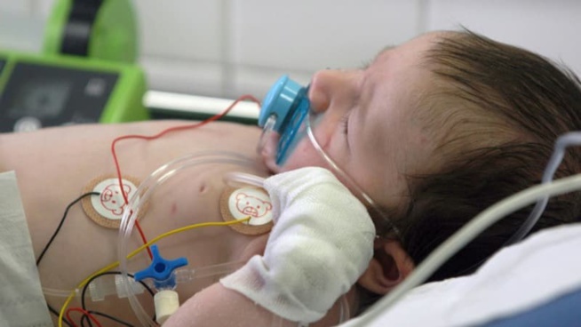 Les cas de bronchiolite en hausse: quels symptômes doivent alerter chez l'enfant?