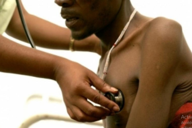Tuberculose/ Oms: La maladie a tué 1,5 million de personnes en 2020