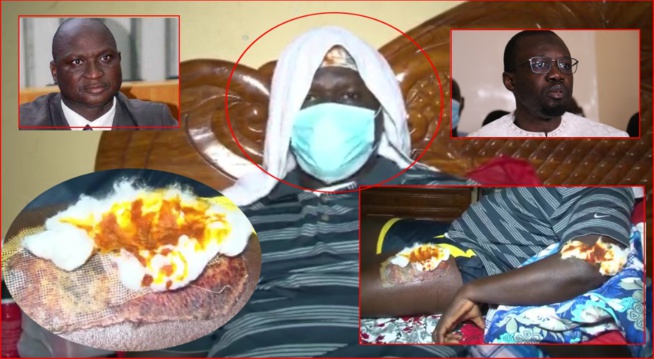 Attaque supposée de la maison familiale de Sonko à Ziguinchor : “Un des accusés recadre Abdou Sané, coordinateur de PASTEF/ Ziguinchor Attaque supposée de la maison familiale de Sonko à Ziguinchor : “Un des accusés recadre Abdou Sané, coordinateur de PASTEF/ Ziguinchor