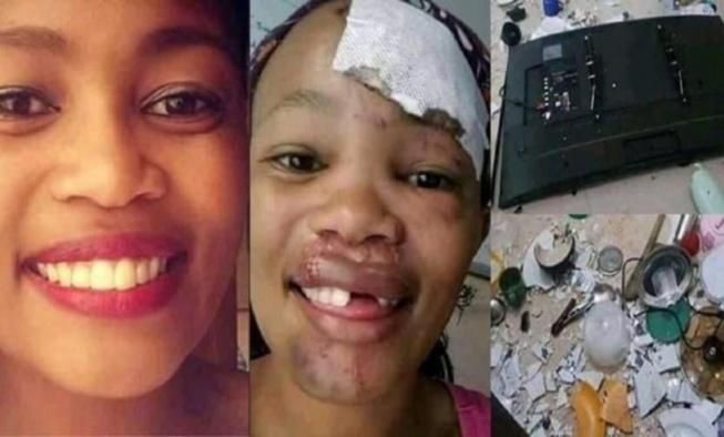 Un homme arrache les dents de sa petite amie avec une pince, pour avoir détruit ses biens Un homme arrache les dents de sa petite amie avec une pince, pour avoir détruit ses biens