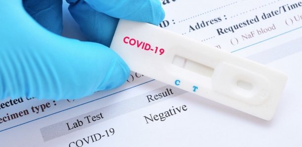 Covid-19 : 4 nouveaux tests positifs, dont 2 cas contacts et 3 cas graves signalés