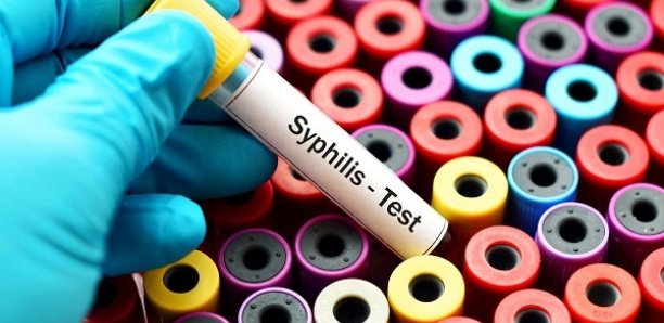 Infection à la syphilis : 1,3 million de femmes séropositives enceintes concernées