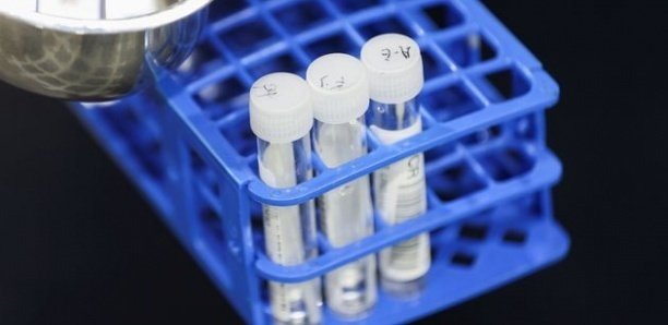 Omicron au Sénégal : Les CTE en alerte maximale, vers l’interdiction des rassemblements ? Omicron au Sénégal : Les CTE en alerte maximale, vers l’interdiction des rassemblements ?