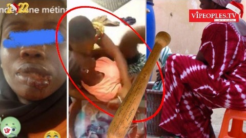 URGENT- Agressée par sa patronne, la Domestique brise le silence: "defma begon ray kour lama door, " URGENT- Agressée par sa patronne, la Domestique brise le silence: "defma begon ray kour lama door, "