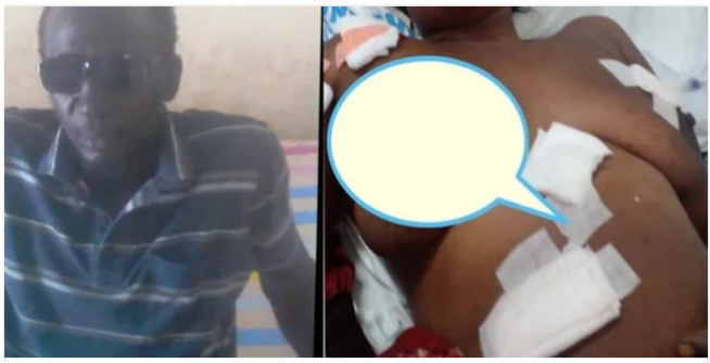 Drame à Khombole: L’autopsie révèle une fracture crânienne Drame à Khombole: L’autopsie révèle une fracture crânienne