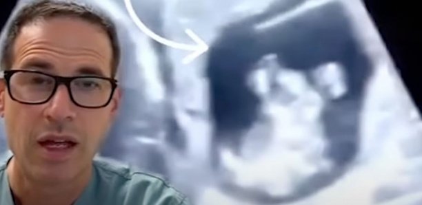 Au Canada, un cas rarissime de grossesse dans le foie Au Canada, un cas rarissime de grossesse dans le foie