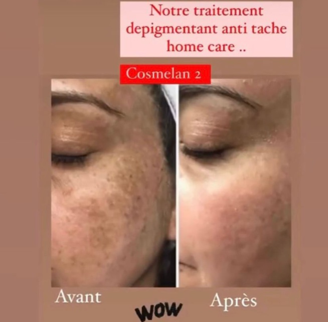 Urgent: OMNYSENS BEAUTE SANTE: découvrez l' expertise et la qualité de vos soins de visages et de la peau Urgent: OMNYSENS BEAUTE SANTE: découvrez l' expertise et la qualité de vos soins de visages et de la peau