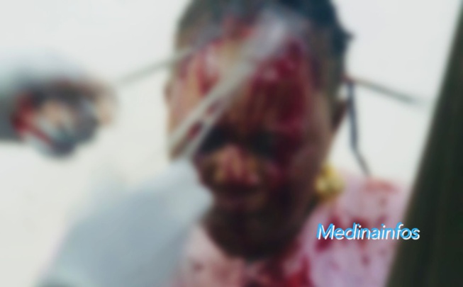 URGENT: Démarrage de la campagne électorale : Les violences débutent à la Medina, Fatou Wade agressée à la lame par Astou Sene URGENT: Démarrage de la campagne électorale : Les violences débutent à la Medina, Fatou Wade agressée à la lame par Astou Sene