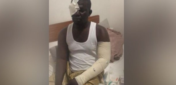 Violences politique : Un partisan de Serigne Mboup attaqué à Médina Baye Violences politique : Un partisan de Serigne Mboup attaqué à Médina Baye