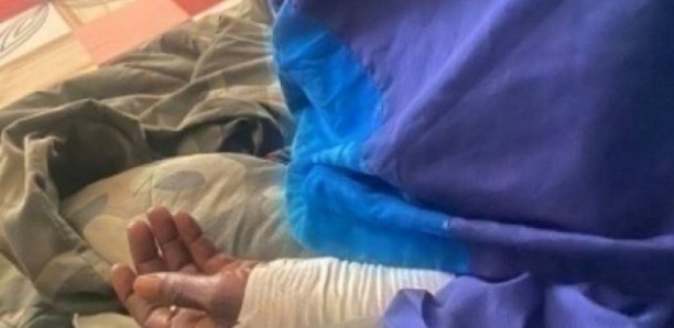 Brûlé vif à Keur Massar: Amadou Sall succombe à ses blessures Brûlé vif à Keur Massar: Amadou Sall succombe à ses blessures