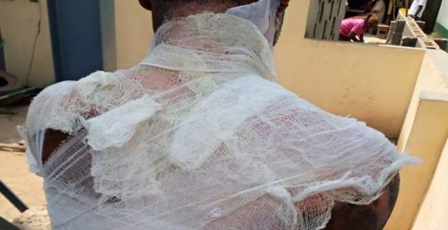 Elle tue son mari en lui versant de l’eau chaude sur le corps, alors qu’il dormait Elle tue son mari en lui versant de l’eau chaude sur le corps, alors qu’il dormait